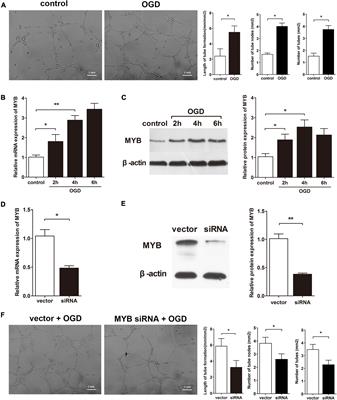 A Feedback Loop Involving MicroRNA-150 and MYB Regulates VEGF Expression in Brain Microvascular Endothelial Cells After Oxygen Glucose Deprivation